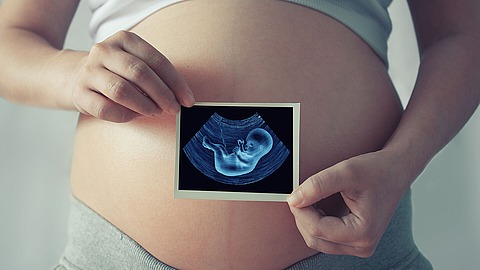 Eine schwangere Person hält ein Ultraschallbild vor ihren nackten Bauch, das einen sich entwickelnden Fötus im Mutterleib zeigt.